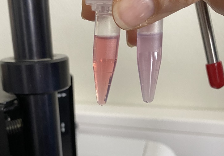 Image of the test of the Method to determine the presence and / or stage of malignant tumours using a urine sample.